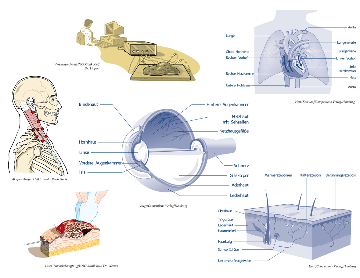 Medizinische Illustrationen © Ulrich Hecker Companions HNO Kiel